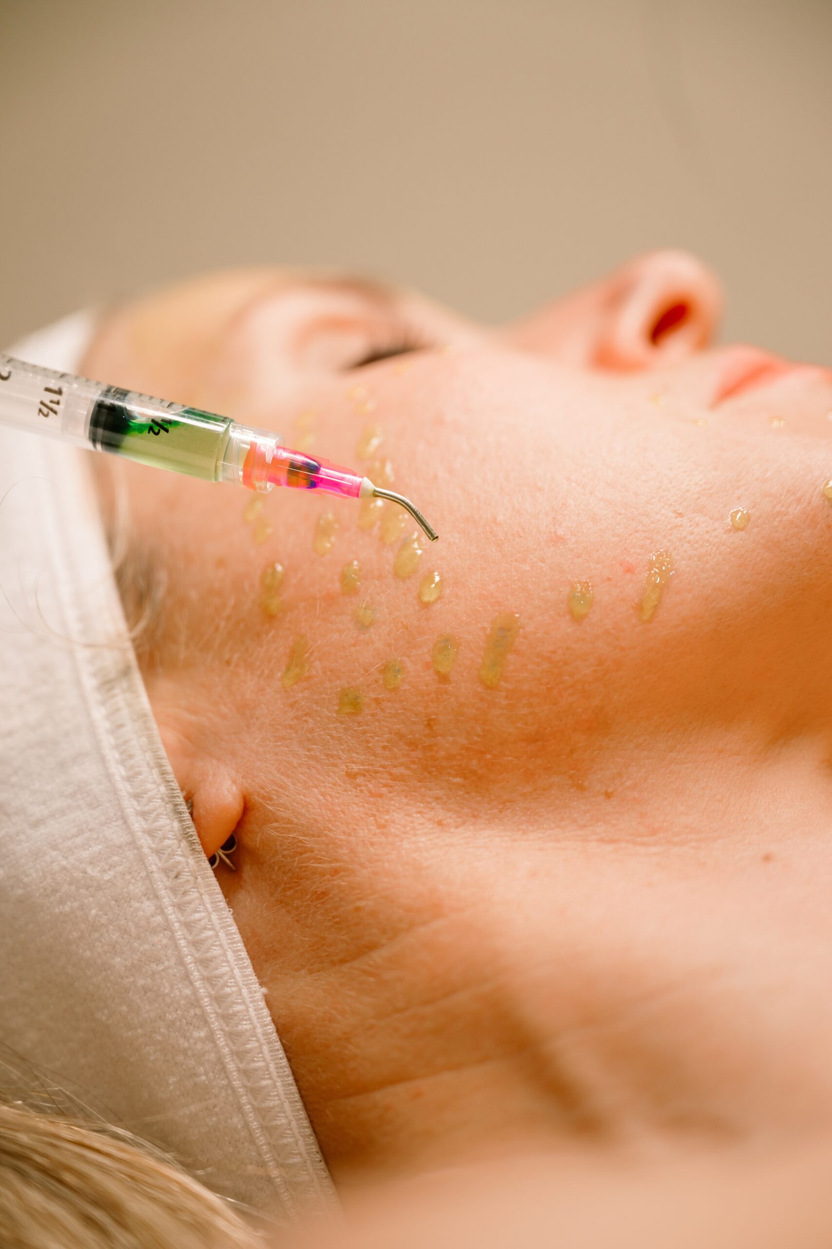 Details of a woman receiving a med spa treatment with a needle using green liquid drops for stock photos vs real photos
